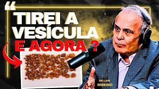 Dr. Lair Ribeiro  TIREI A VESÍCULA E AGORA ?  - PEDRAS NA VESÍCULA.