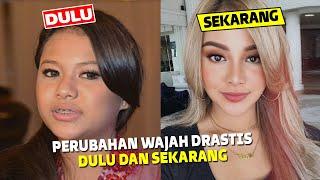 BEDA BANGET 5 ARTIS DENGAN PERUBAHAN WAJAH YANG DRASTIS