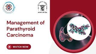 Management of Parathyroid Carcinoma