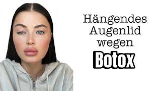 Augenlid hängt nach Botox Behandlung Browlift