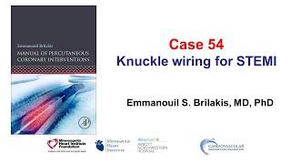 Case 54 PCI Manual - Knuckle wiring for STEMI