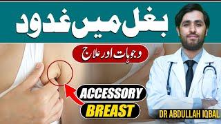 Painful Armpit Fat or Armpit Lump  Bagal ki Charbi Ka Ilaj  Treatment of Underarm Fat