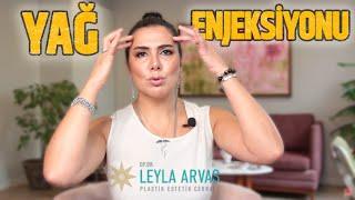 YÜZE YAĞ ENJEKSİYONU KALICI MI?  Op. Dr. Leyla Arvas