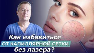 ЛУЧШИЙ МЕТОД избавиться ОТ СОСУДИСТЫХ ЗВЁЗДОЧЕК Как вылечить капиллярные сетки на ногах без лазера?