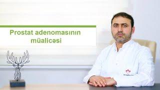 Prostat adenomasının müalicəsi