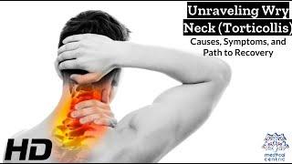 Wry Neck Torticollis The Silent Struggle and How to Overcome It