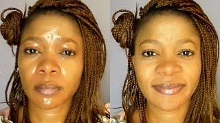 HOW TO STOP EXCESSIVE OIL ON THE FACE FOREVER BEST HOME REMEDY FOR OILY FACE