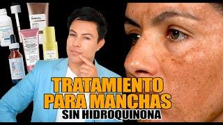 Tratamiento Para Melasma Sin Hidroquinona