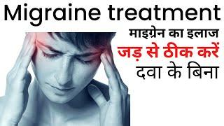 Migraine ka ilaj  Migraine treatment at home in Hindi