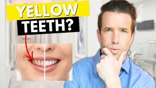 Yellow teeth? Listen up