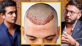 Affordable Hair Transplant In India - Cost Side Effects & Precautions Explained By Top Dermat