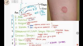 9 Jenis Dermatitis  Review Singkat Klasifikasi Dermatitis