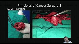 Lecture-1  Principles of Surgical Oncology by Dr. Tarun Kumar IMS BHU