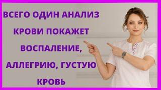 Смотри как определить густую кровь воспаление наличие паразитов всего по одному анализу крови.