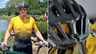 Gordon Ramsay Bike Accident And Shows Off Massive Bruise In Video