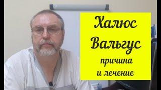 Халюс Вальгус Hallux valgus. Настоящая причина данной проблемы.