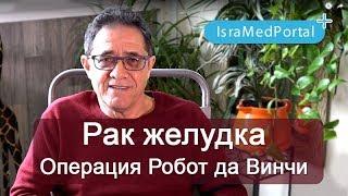 Рак желудка. Отзыв после операции Робот да Винчи