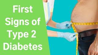 What are the warning signs of type 2 diabetes?