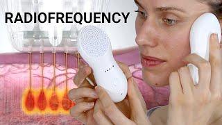 Radiofrequency Skin Tightening Treatments - Do They Really Work & If So How? Nebulyft Science