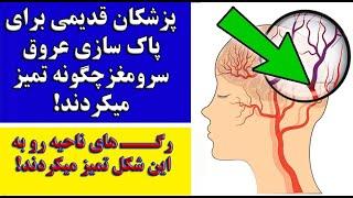 پاک سازی عروق سرومغزرگـــ های ناحیه رو به این شکل تمیز میکردند