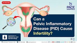 Can a Pelvic Inflammatory Disease PID cause Infertility?  #PID #shortsvideo