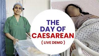 The day of caesarean Live Demo-  Dr Asha Gavade