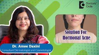 Hormonal Acne  Resistant Acne Causes & Treatment #pimples #acne - Dr. Amee Daxini  Doctors Circle