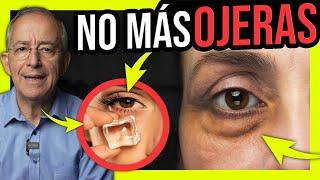 ️ OLVIDATE De Las OJERAS Con SOLUCIONES EFECTIVAS Y NATURALES - Oswaldo Restrepo RSC