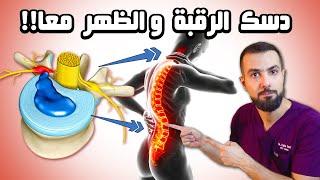 علاج انزلاق الدسك في الرقبة والظهر معا بـ 5 خطوات  الحلقة الكاملة