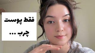 پوست چرب و جوشدار داری باید بدونی  Oily skin must Knows