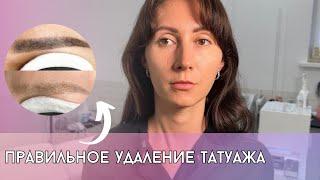 Хочешь удалить старый перманентный макияж? Удаление татуажа лазером и ремувером