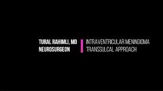 Intraventricular Meningioma. Temporal transsulcal approach.