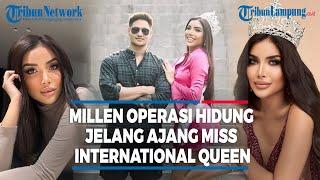 Millen Cyrus Operasi Hidung Jelang Ajang Miss International Queen 2023