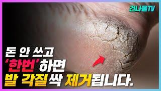 발 각질 제거 돈 쓰지 말고 이것 한번으로 매끈하게 싹 사라집니다