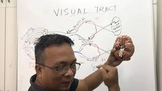 VISUAL PATHWAY  AND ITS LESIONS