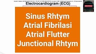 SERI PEMBELAJARAN PERAWAT  GAMBARAN EKG PART.2