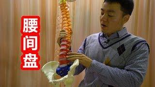 医学实例详解：腰椎间盘突出的保守治疗第1招，自我缓解腰腿痛