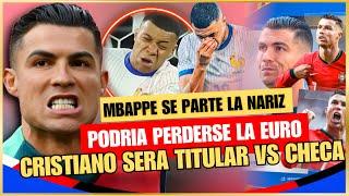  MBAPPE se ROMPE la NARIZ y PUEDE PERDERSE la EURO  CRISTIANO SERA TITULAR vs CHECA  PREVIA