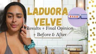 LADUORA VELVE FINAL OPINION  RED LIGHT THERAPY RESULTS