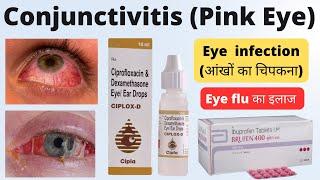 Treatment of Eye Flu in Hindi  Eye flu  आंखों का चिपकना का इलाज  Conjunctivitis in hindi