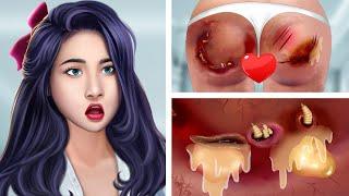 ASMR Treat infected wounds on the buttocks & Remove dog ticks  Deep Cleaning Animation