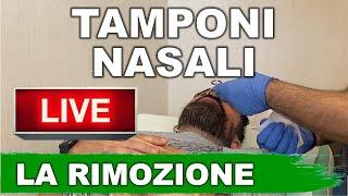 Tamponi nasali dopo intervento di settoplastica Il cervello è ancora attaccato?