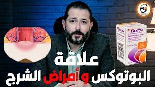 ايه هي علاقة البوتوكس بأمراض الشرج .. أعرف اكتر من الدكتور #رامي_صلاح_الدين