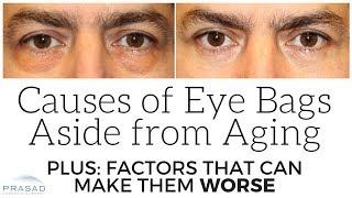 Causes of Puffy Eye Bags Aside from Aging and Stress Factors than can Make Them Worse