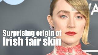Surprising origin of Irish fair skin far away from Ireland
