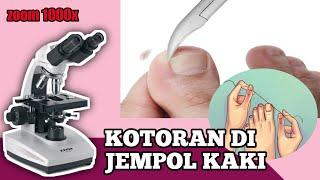 ZOOM 1000X‼️KOTORAN KUKU DI JEMPOL KAKI