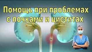 У Вас проблемы с  почкамициститэто натуральное средство обязательно Вам поможет.