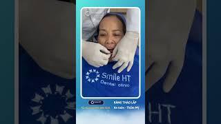 Phục hình răng là một trong những dịch vụ mũi nhọn tại Smile HT  #feedback#smileht#nhakhoasmileht