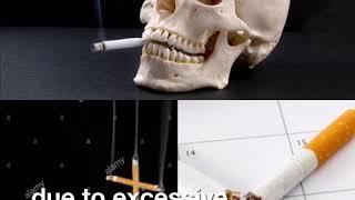 Smoking is a DEAD End