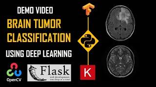 Deep Learning ProjectBrain Tumor Classification  DEMO  Keras Python Tensorflow  KNOWLEDGE DOCTOR